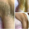 Шугаринг ( Сахарная эпиляция) с выездом на дом 