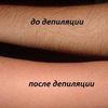 Шугаринг разных зон