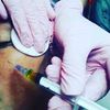 Мезотерапия лица