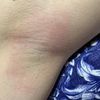 Приглашаю девушек на сахарную депиляцию 
