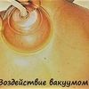 Вакуумно-роликовый массаж